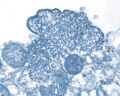 Nipah – nowy superwirus odkryty przez WHO? Tylko w polskich mediach