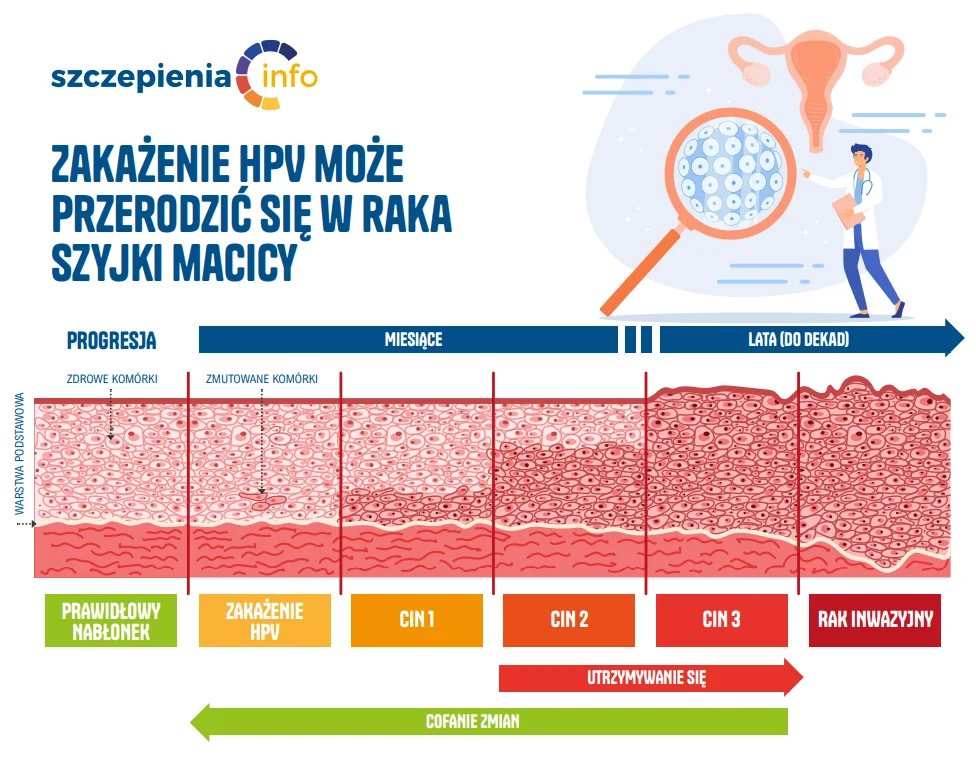 zakażenie HPV